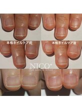 ニコプラス(NICO+)/ジェルネイルができない方向け