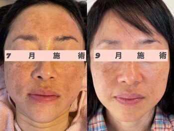 サクラ(SAKURA)/お客様のビフォーアフター