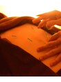 鍼灸師 かわなみこうき みなさんの体調が良くなるように技術を磨いています!!