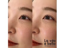 ラヴィータエベッラ(La Vita e Bella)/話題のメーテルロッド