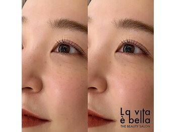 ラヴィータエベッラ(La Vita e Bella)/話題のメーテルロッド