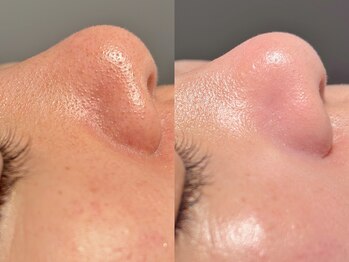 ルーナジェーナ(Luna llena)/