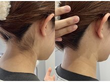 シロ(Shiro)/うなじデザイン