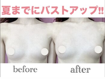 カピリナ(KA PILINA)/施術1回目バストアップ