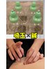 【初回◇重だるさ解消！】吸玉＋お試し鍼セット　¥3,980