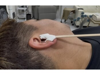 アンビー(Ambee)/追加メニュー/耳毛ワックス