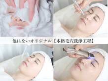 シャルトルズ 西宮北口店の雰囲気(他店にはない徹底したアプローチが自慢の毛穴洗浄工程)