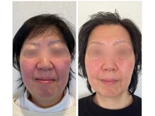 Beauty Share Salon ASBEAUTE【毛穴/フェイシャル】