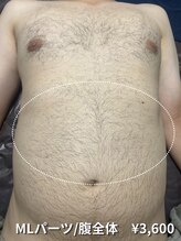 カナウ(KANAU)/【MLパーツ/脱毛】腹全体