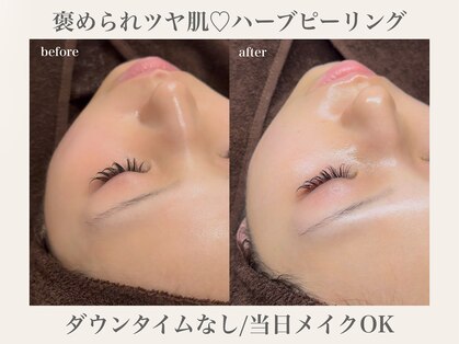 ベルスキン(Bell skin)の写真