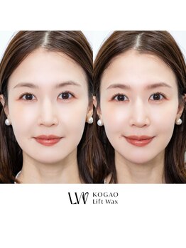ポノ(pono)の写真/【美容成分配合スキンワックス×デンキバリブラシ】タイパ抜群の新メニューでお肌ツヤツヤ小顔見え