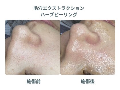 プラスボーテ 幡ヶ谷(plus beaute)の写真