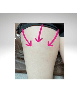 スーコ(SU:CO)/【ホワフラ】美白ビフォアフ