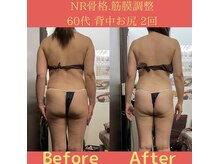 リラクゼーションサロン ラキ(laki)/NR筋膜骨格調整２回