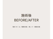 ゆくる/before after