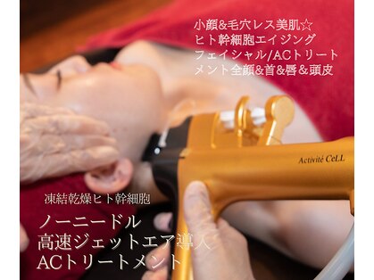 フランジパニ(FRANGIPANI)の写真