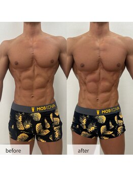 ヴィーナス(Venus)/スタッフ痩身/上半身カット出し