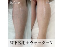 コアラッシュ 福井フェニックス通り店(COA LASH)の雰囲気(赤みも出にくく、痛みも少なく!コアラッシュで、できます♪)