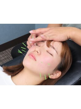 ホウレイ線・たるみ改善！予防ケア