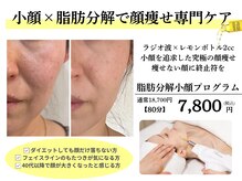 クレビア(Clevia)の雰囲気（〈小顔×レモンボトル〉ラジオ波と話題のレモンボトルで即小顔）