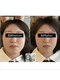 キュープ 下関店(Qpu)の写真/オールハンド施術で痛みのないじんわり指圧◎たった２０分、お顔の左右差、もたつき、凝りがスッキリ◎