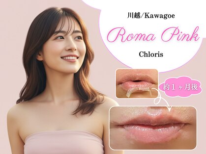 クローリス(Chloris)の写真