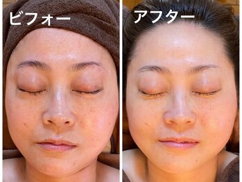 ナオフクオカ ヒーリングフォースエヌ(NaoFukuoka/healingforceN)/別人級の変化を求める貴女へ!