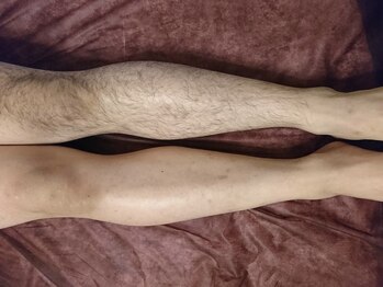 ルテラ(Lutella)の写真/メンズ脱毛で全身ツルスベ肌へ！ヒゲ脱毛や顔脱毛で清潔感を磨くサロン♪
