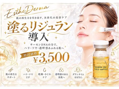 ティンク(Tink)の写真