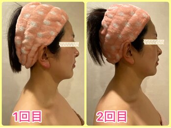 美肌痩身サロン ラエルヴェ(La Elever)/小顔リフトアップ大作戦！ &nbsp;