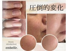 アンベリール(embellir.)