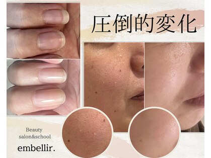 アンベリール(embellir.)の写真