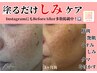 【先着10名★5月末まで限定価格】本気でシミ改善☆(90分)13,200円→