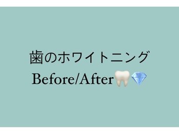 ホワイトニングショップ 明石大久保店/