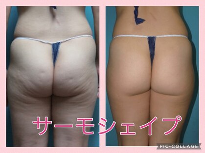 トータルスキンケア 美容ルーム(美容Room)の写真
