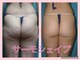 トータルスキンケア 美容ルーム(美容Room)の写真