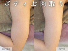 レヴェリー 心斎橋店(REVERIE)/‐ BODYお肉取り ‐