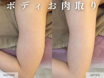 レヴェリー 心斎橋店(REVERIE)/‐ BODYお肉取り ‐
