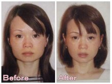 ドクター ヴィーナス/エラがなくなり、輪郭が別人級！