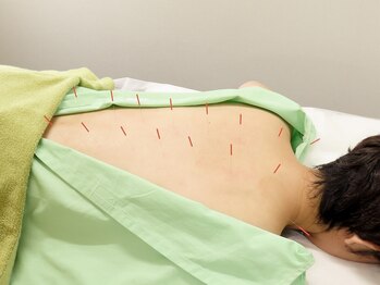 鍼灸治療院養源堂 西小山院の写真/【自律神経の乱れなどお悩みの方必見★】慢性疲労/頭痛/不眠/動悸・不安/内臓の不調など難しい症状にお勧め