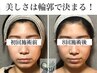 《再来の方》小顔頭蓋骨矯正＋リンパケア8回コース　￥61600→￥41600