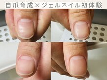 初日に来店され、育爪ケアをするともうこんなに綺麗！