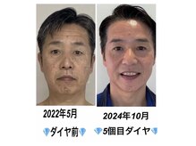 リーシャ(Reesha)/ダイヤモンドピールプログラム