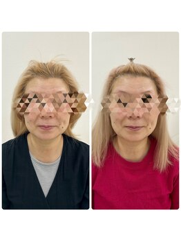 ブプラ 松本店(BUPURA)/