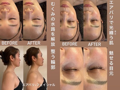 アンミー(anmiiy)の写真