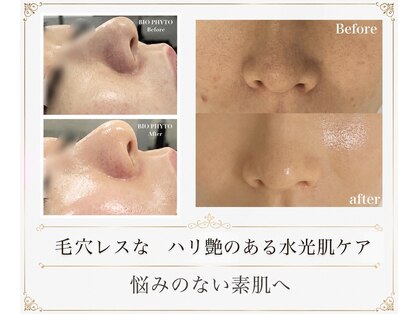 ミベル(MeBell)の写真