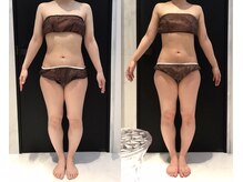 リボディ 表参道(An re Body)/before→after