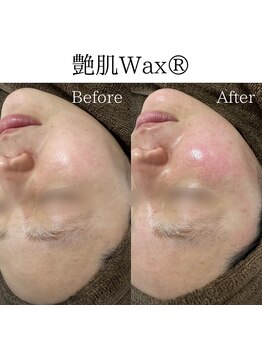 ビューティービューティー(BEAUTY BEAUTY)/艶肌ワックス