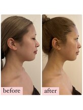 心奏(cocokana)/ブライダルケア