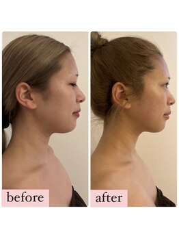 心奏(cocokana)/ブライダルケア